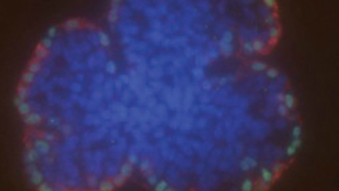 Model Mammary Gland - v.2