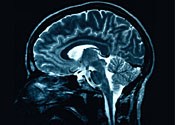 Huntington's research