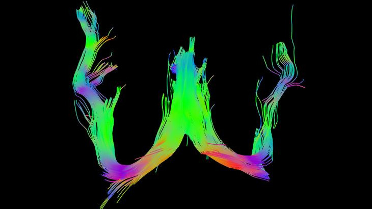 NeuroSwipe image for users