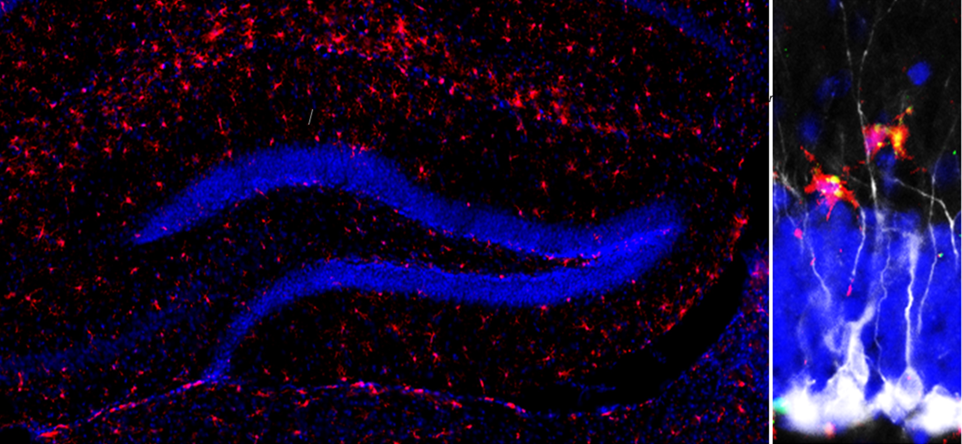 Microglia