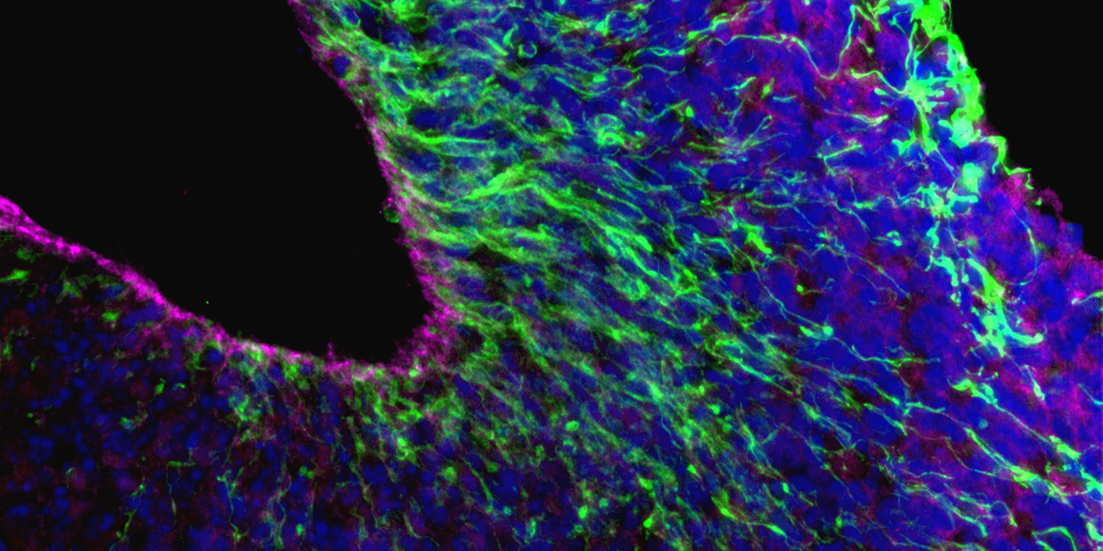 Brain cells in dish