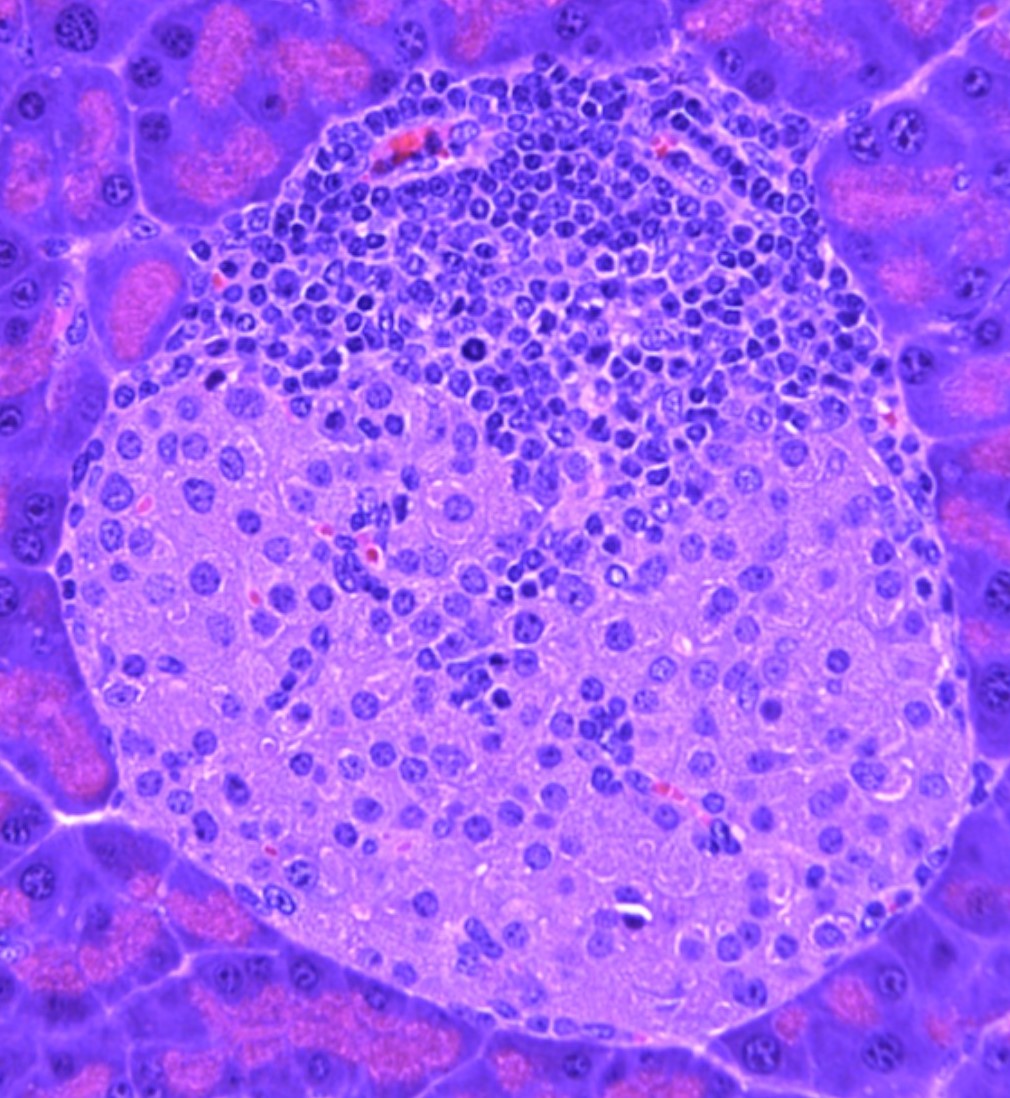 Islet of Langerhans