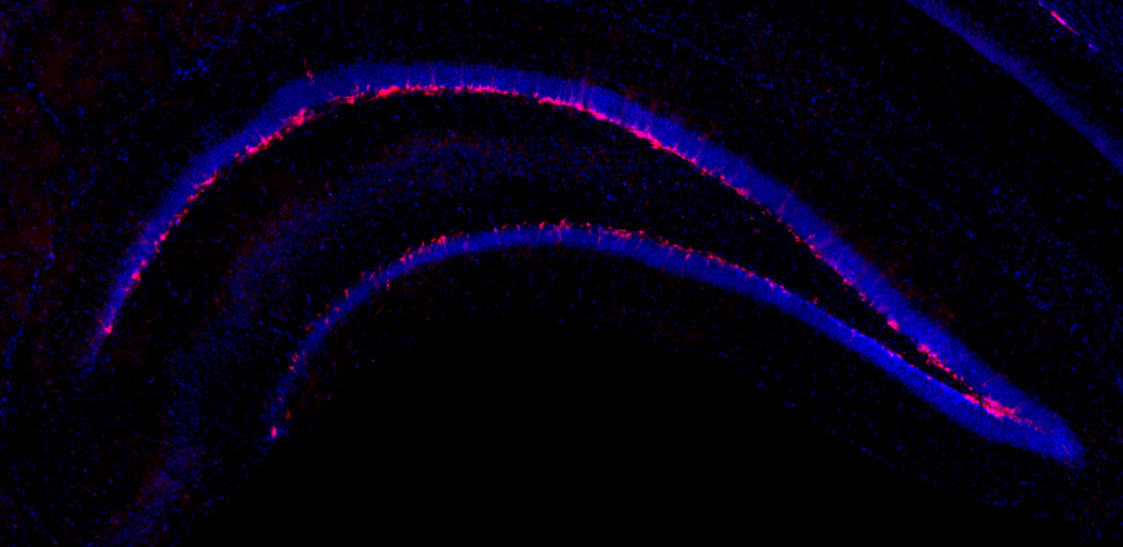 New neurons in hippocampus