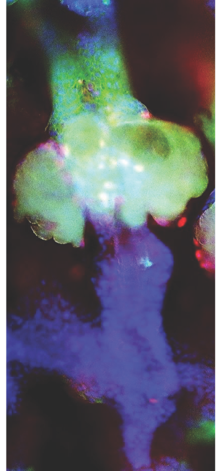 Mouse hair follicle