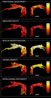 Atlas of the human brain