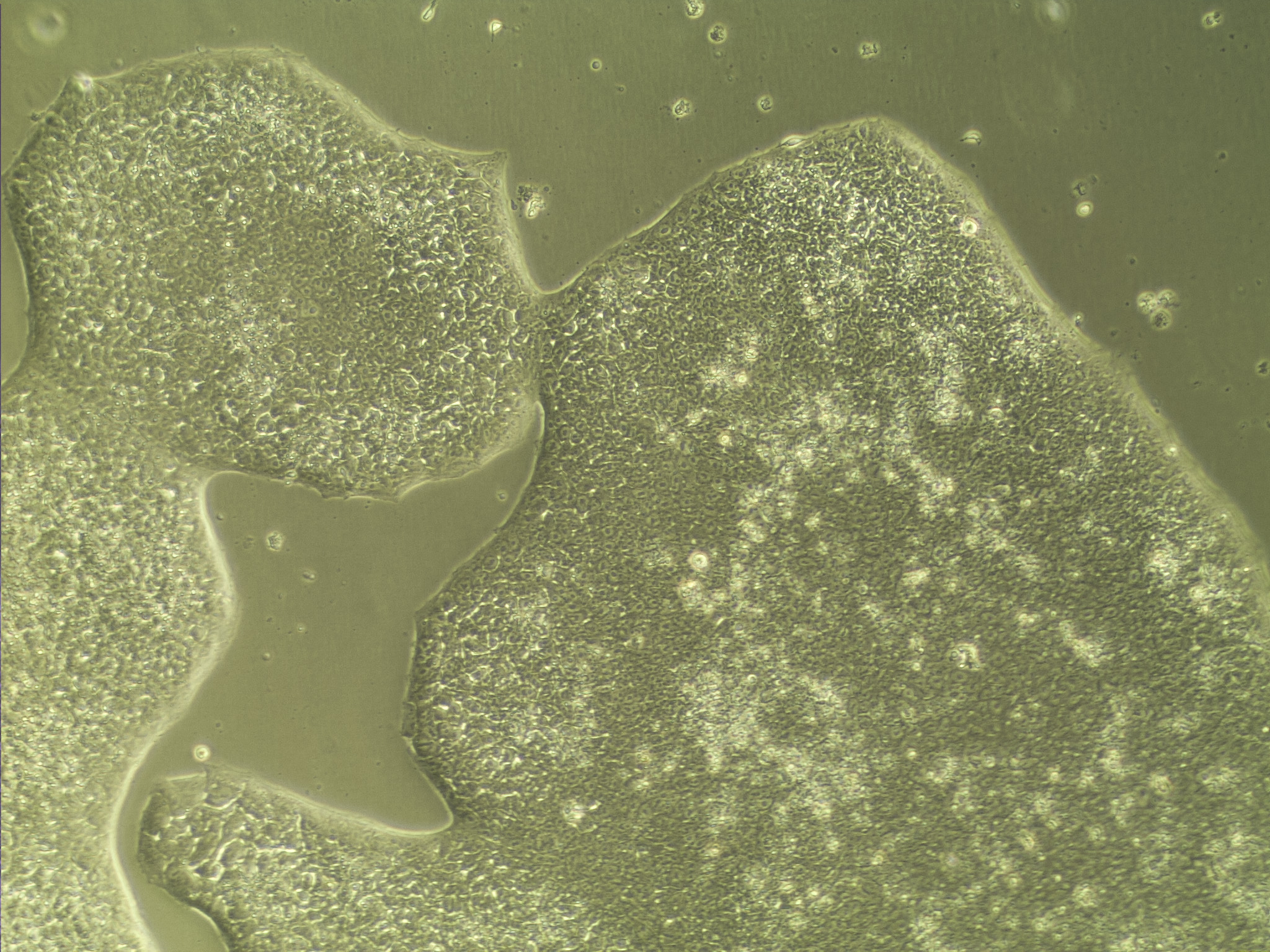 Undifferentiated stem cells